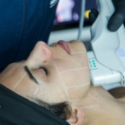 Skin-lifting-a-base-di-energia-il-futuro-della-medicina-estetica Skin lifting a base di energia il futuro della medicina estetica